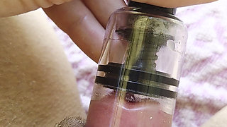 A Swollen Clitoris Looks Even Fleshier up Close