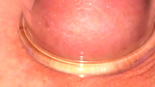 Nipple Cupping Part 2