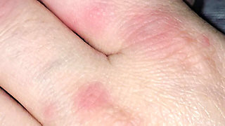 Step mom hand has allergy on step son dick while handjob