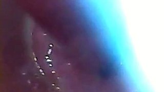 Endoscope POV: Test Tube Cock Urethral Insertion