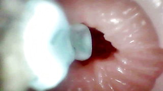 A detailed examination of Lopuza93 oral cavity and anal area using an endoscope camera.