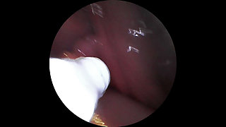 Camera Inside My Wife’s Pussy and Squirt