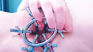 Speculum