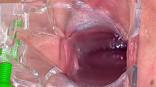 Anal Temperature Measurement of Hot 18yo Teen Bella Angel