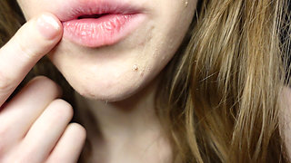 I Tell You About the Fillings in My Teeth and Dental Visits
