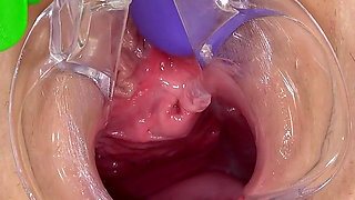 Beautiful Teen Gets Anal Orgasm with a Speculum Inside Her Pussy