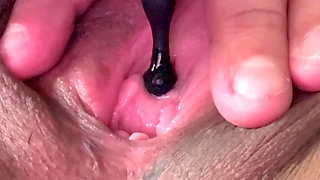 peehole Squirting