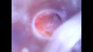 View Inside Cock While Jerking and Cumshot ( Camera Inside Dick )