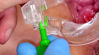 Cervical Examination of a Young Muslim Zeynep Rossa