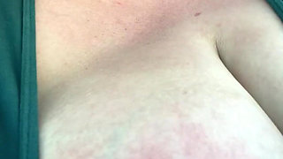 Got a Sunburn for Art Supplies!