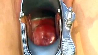 This Naughty German Babe Cant Stop Spreading Her Pussy
