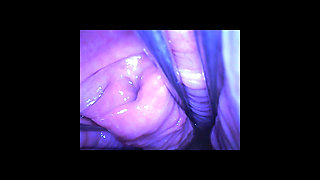 Speculum & Microcamera for Lady Soniac