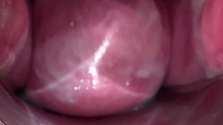 Masked Schoolgirl Extreme Cervix View and Double Vaginal Fisting